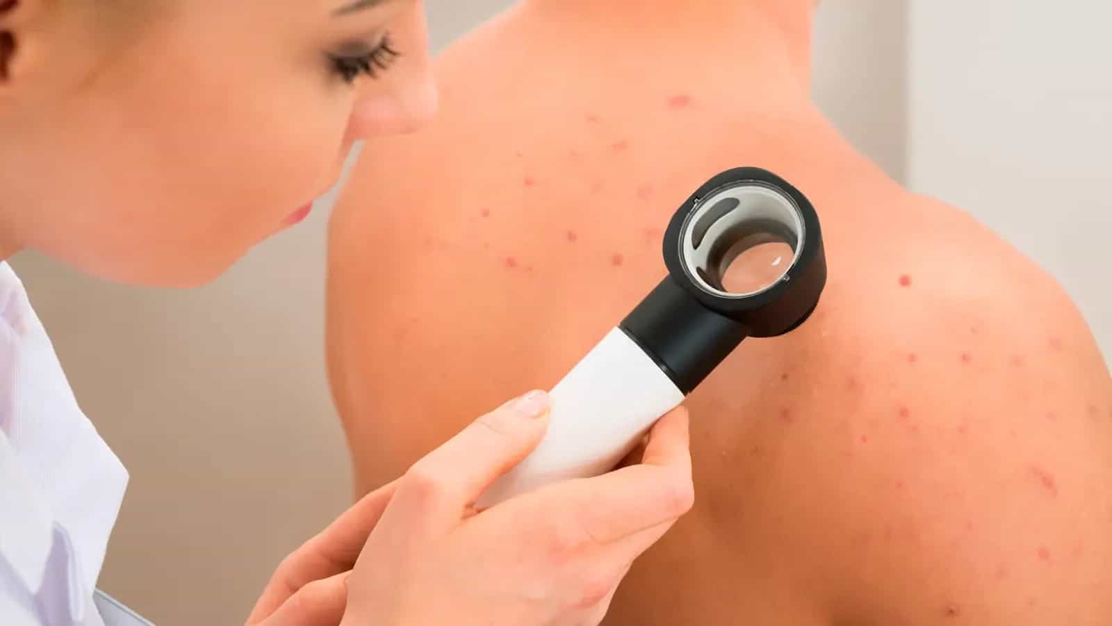Dermatologiya
